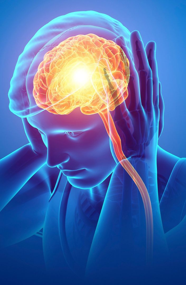 Illustration of Brain with Migraine